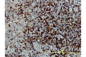 Immunoperoxidase of monoclonal antibody to CAMK4 on formalin-fixed paraffin-embedded human tonsil tissue. (CAMK4 antibody  (AA 1-473))