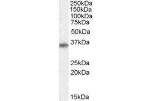 Western Blotting (WB) image for anti-Uncoupling Protein 2 (Mitochondrial, Proton Carrier) (UCP2) (Internal Region) antibody (ABIN2466417) (UCP2 antibody  (Internal Region))