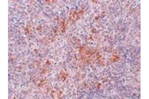 Immunohistochemistry (IHC) image for anti-Angiotensin II Receptor, Type 1 (AGTR1) (Middle Region) antibody (ABIN1030844) (Angiotensin II Type-1 Receptor antibody  (Middle Region))