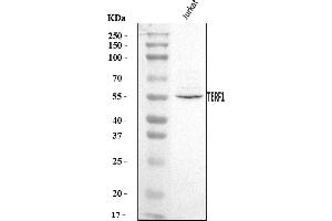 Western blot analysis of TRF1/TERF1 using anti-TRF1/TERF1 antibody (ABIN7599802).