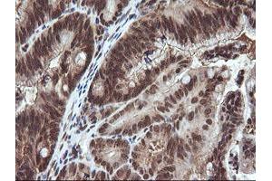 Image no. 1 for anti-Von Hippel-Lindau Tumor Suppressor, E3 Ubiquitin Protein Ligase (VHL) antibody (ABIN1501712) (VHL antibody)