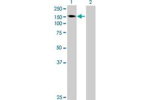 Western Blot analysis of AKAP1 expression in transfected 293T cell line by AKAP1 MaxPab polyclonal antibody. (AKAP1 antibody  (AA 1-903))