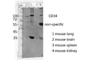 Western Blot (WB) analysis: Please contact us for more details. (CD34 antibody  (Internal Region))
