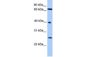 WB Suggested Anti-L3MBTL2 Antibody Titration: 0. (L3MBTL2 antibody  (N-Term))