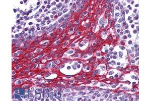 Immunohistochemistry (IHC) image for anti-Forkhead Box O3 (FOXO3) (C-Term) antibody (ABIN185248)
