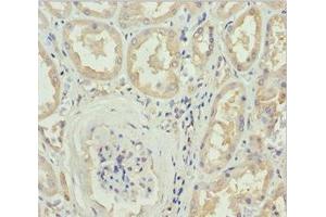 Immunohistochemistry of paraffin-embedded human kidney tissue using ABIN7149603 at dilution of 1:100 (DOCK8 antibody  (AA 1900-2099))
