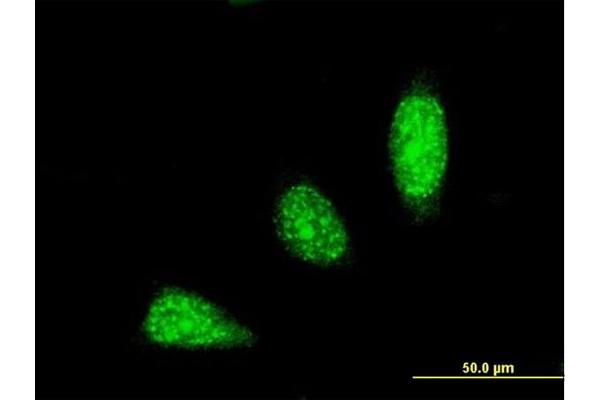 TRIM31 antibody  (AA 1-100)