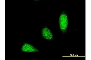 Immunofluorescence of monoclonal antibody to TRIM31 on HeLa cell. (TRIM31 antibody  (AA 1-100))