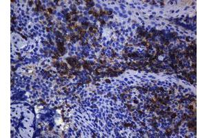 Immunohistochemistry (IHC) image for anti-T-cell surface glycoprotein CD1c (CD1C) antibody (ABIN2670676) (CD1c antibody)
