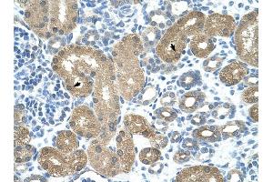 TRNT1 antibody was used for immunohistochemistry at a concentration of 16.