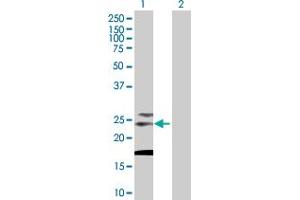 Western Blot analysis of TSPAN31 expression in transfected 293T cell line by TSPAN31 MaxPab polyclonal antibody.