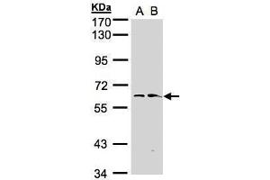 WB Image Sample(30 ug whole cell lysate) A:Hep G2 , B:Raji , 7. (FMO1 antibody)