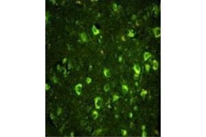 Immunofluorescence (IF) image for anti-Abl-Interactor 1 (ABI1) antibody (ABIN3003792) (ABI1 antibody)