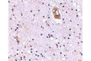Immunohistochemistry of EVER2 in human brain with EVER2 antibody at 5 μg/ml. (TMC8 antibody  (Center))