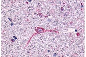 Anti-NTSR1 antibody  ABIN1049154 IHC staining of human brain, neurons and glia. (NTSR1 antibody  (N-Term))