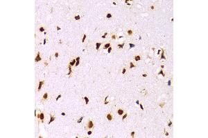 Immunohistochemistry of paraffin-embedded Mouse brain using Histone H3 antibody at dilution of 1:100 (x400 lens). (Histone 3 antibody  (C-Term))