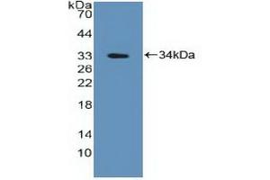 Detection of Recombinant PTPN2, Human using Polyclonal Antibody to Protein Tyrosine Phosphatase, Non Receptor Type 2 (PTPN2) (PTPN2 antibody  (AA 1-257))