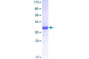 Tetraspanin 6 Protein (TSPAN6) (AA 115-208) (GST tag)