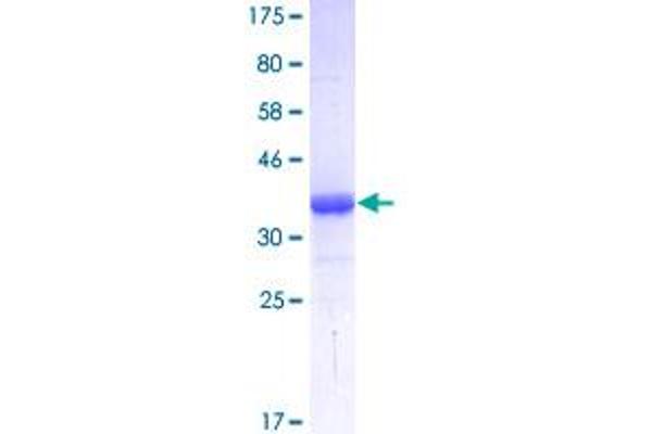Tetraspanin 6 Protein (TSPAN6) (AA 115-208) (GST tag)