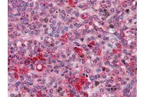 Immunohistochemical analysis of paraffin-embedded human Spleen tissues using FGR mouse mAb (Fgr antibody)