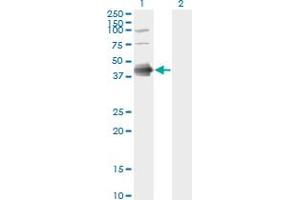 anti-Fc Fragment of IgE, Low Affinity II, Receptor For (CD23) (FCER2) (AA 1-321) antibody
