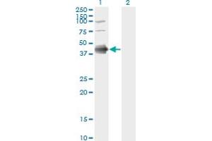 Western Blot analysis of FCER2 expression in transfected 293T cell line by FCER2 monoclonal antibody (M03), clone S52. (FCER2 antibody  (AA 1-321))
