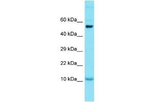 Host: Rabbit Target Name: GCSAML Sample Type: Placenta lysates Antibody Dilution: 1.