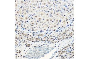 Immunohistochemistry of paraffin-embedded rat ovary using Pan-Akt Rabbit pAb (ABIN7265520) at dilution of 1:100 (40x lens). (AKT 1/2/3 antibody)