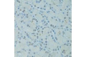 Immunohistochemistry of paraffin-embedded rat pancreas using GTF2H2C antibody (ABIN5973022) at dilution of 1/100 (40x lens). (GTF2H2C antibody)