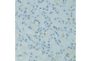 Immunohistochemistry of paraffin-embedded rat pancreas using GTF2H2C antibody (ABIN5973022) at dilution of 1/100 (40x lens).