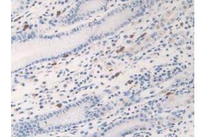 IHC-P analysis of Human Stomach Tissue, with DAB staining. (Kallikrein 6 antibody  (AA 17-244))