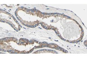 ABIN6269185 at 1/100 staining Human prostate tissue by IHC-P. (TNNI3 antibody)