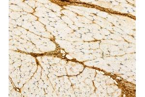 ABIN7094299 and ABIN7098346 at 1/100 staining Rat skin tissue by IHC-P. (IGSF21 antibody  (C-Term))