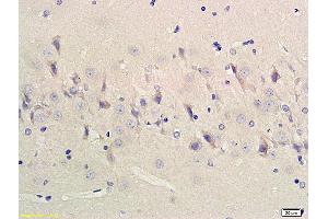 Formalin-fixed and paraffin embedded rat cerebrum labeled with Anti-ChAT Polyclonal Antibody, Unconjugated (ABIN724070) 1:200followed by conjugation to the secondary antibody and DAB staining (Choline Acetyltransferase antibody  (AA 101-200))