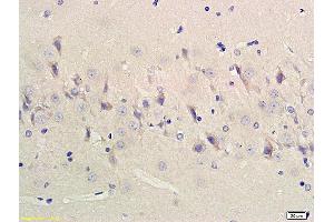 Formalin-fixed and paraffin embedded rat cerebrum labeled with Anti-ChAT Polyclonal Antibody, Unconjugated (ABIN724070) 1:200followed by conjugation to the secondary antibody and DAB staining