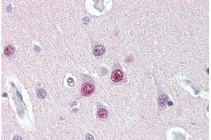 Human Brain, Cortex (formalin-fixed, paraffin-embedded) stained with UBQLN1 antibody ABIN396937 at 10 ug/ml followed by biotinylated anti-mouse IgG secondary antibody ABIN481714, alkaline phosphatase-streptavidin and chromogen. (Ubiquilin 1 antibody  (Internal Region))