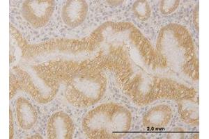 Image no. 1 for anti-Protocadherin alpha 10 (PCDHA10) (AA 182-291) antibody (ABIN599279) (PCDHA10 antibody  (AA 182-291))