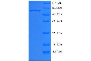 Calpain 2, (M/II) Large Subunit (CAPN2) (AA 1-324) protein (His tag) expressed in E. (CAPN2 Protein (AA 1-324) (His tag))