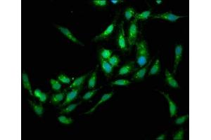 Immunofluorescence staining of Hela cells with ABIN7151786 at 1:133, counter-stained with DAPI. (EDC4 antibody  (AA 753-952))