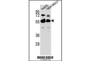 Western blot analysis in HepG2,MDA-MB231 cell line lysates (35ug/lane). (RAP1GDS1 antibody  (AA 217-244))