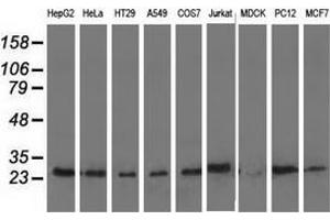 Western blot analysis of extracts (35 µg) from 9 different cell lines by using anti-AK3 monoclonal antibody. (Adenylate Kinase 3 antibody)