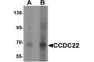 Western blot analysis of CCDC22 in 293 cell lysate with CCDC22 antibody Cat,.