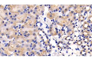 Detection of CD26 in Mouse Kidney Tissue using Polyclonal Antibody to Cluster Of Differentiation 26 (CD26) (DPP4 antibody  (AA 29-178))