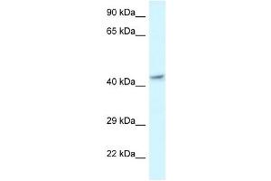 Western Blot showing MECR antibody used at a concentration of 1 ug/ml against Fetal Brain Lysate (MECR antibody  (C-Term))