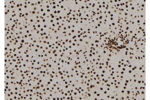 ABIN6277585 at 1/100 staining Rat liver tissue by IHC-P. (NQO2 antibody  (N-Term))