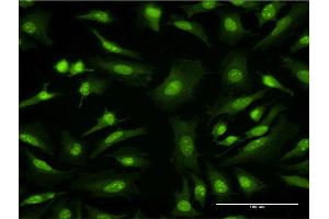 Immunofluorescence of monoclonal antibody to GFRA1 on HeLa cell. (GFRA1 antibody  (AA 32-119))
