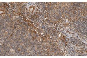 ABIN6266692 at 1/100 staining human Lymph node tissue sections by IHC-P.