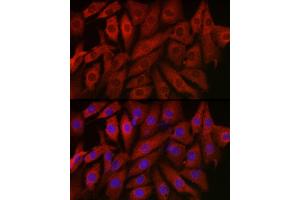 Immunofluorescence (IF) image for anti-Endothelin 1 (EDN1) (AA 18-212) antibody (ABIN3021076)