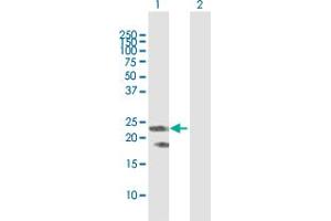 Western Blot analysis of F8 expression in transfected 293T cell line by F8 MaxPab polyclonal antibody. (Factor VIII antibody  (AA 1-216))