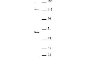 GATA-6 antibody (pAb) tested by Western blot. (GATA6 antibody  (N-Term))